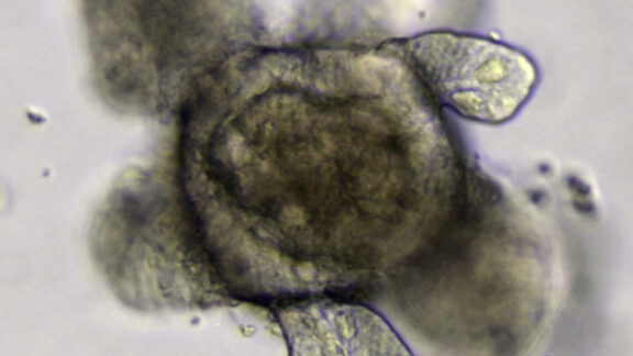 Organoides - Sociedad