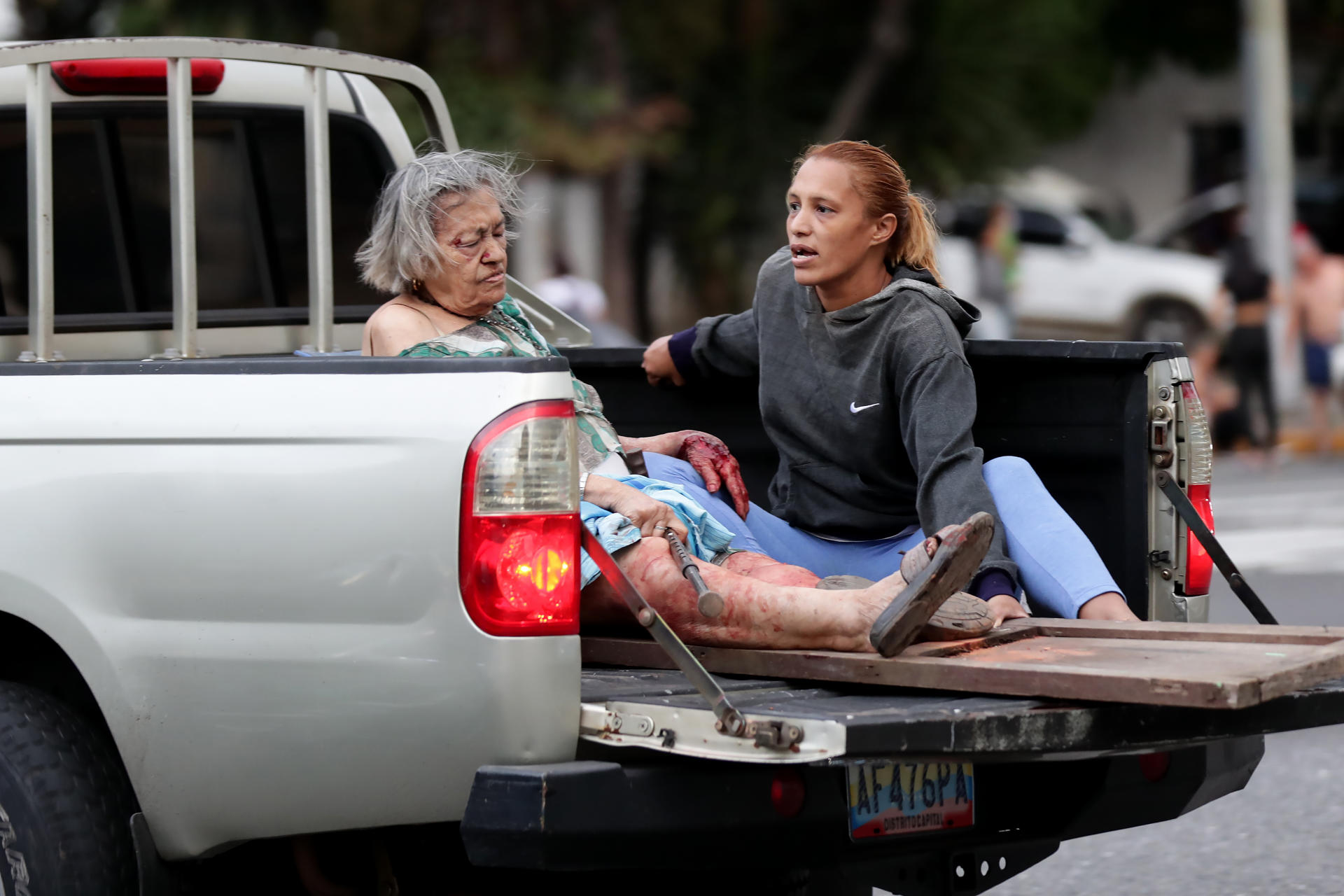 FOTODELDÍA AME4079. CARACAS (VENEZUELA), 24/06/2026.- Una mujer herida es transportada en un vehículo este miércoles, luego de dos fuertes terremotos que sacudieron el Caribe venezolano en Caracas (Venezuela). El evento principal fue un sismo de magnitud 7,5, informó el sistema oficial de alerta de tsunamis de Estados Unidos. EFE/ Ronald Peña R