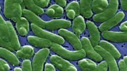 Vibrio vulnificus - Internacional