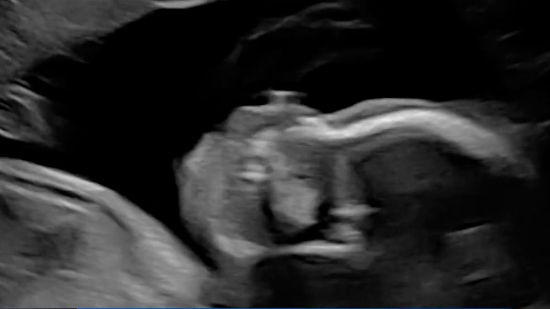 maternidad subrogada