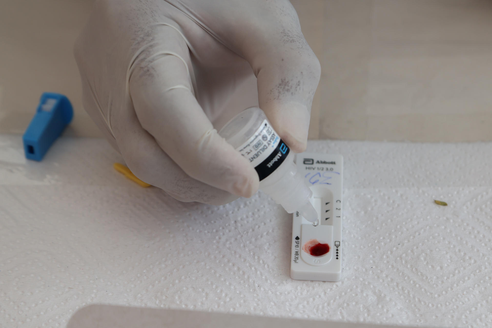 AME3817. CIUDAD DE GUATEMALA (GUATEMALA), 28/11/2025.- Una persona toma una muestra para una prueba rápida de detección del VIH este viernes, en Ciudad de Guatemala (Guatemala). Guatemala enfrenta una situación crítica con 47.978 casos de Virus de Inmunodeficiencia Humana (VIH) registrados en 41 años de epidemia, según datos difundidos por AHF. EFE/ Mariano Macz